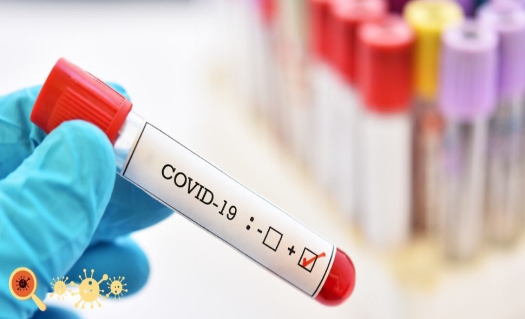 Acre registra 110 novos casos de covid-19 nesta segunda-feira e confirma mais 4 mortes 